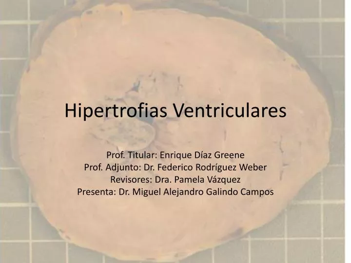 hipertrofias ventriculares