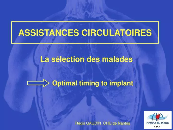 assistances circulatoires