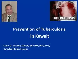 Prevention of Tuberculosis in Kuwait Samir M. Bahnasy, MBBCh,, MSc TMH, DPH, Dr PH, Consultant Epidemiologist