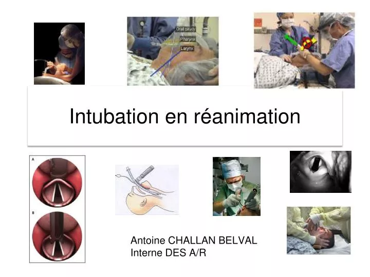 intubation en r animation