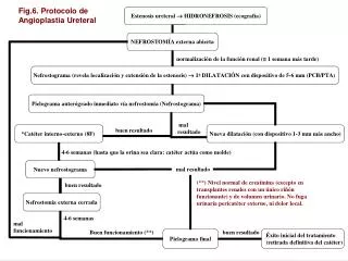 Fig.7.Estenosis ureteral tras transplante renal