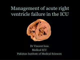 Management of acute right ventricle failure in the ICU