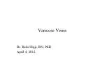 Varicose Veins - slide 1