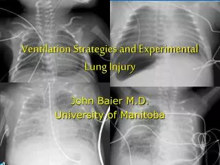 Ventilation Strategies and Experimental Lung Injury