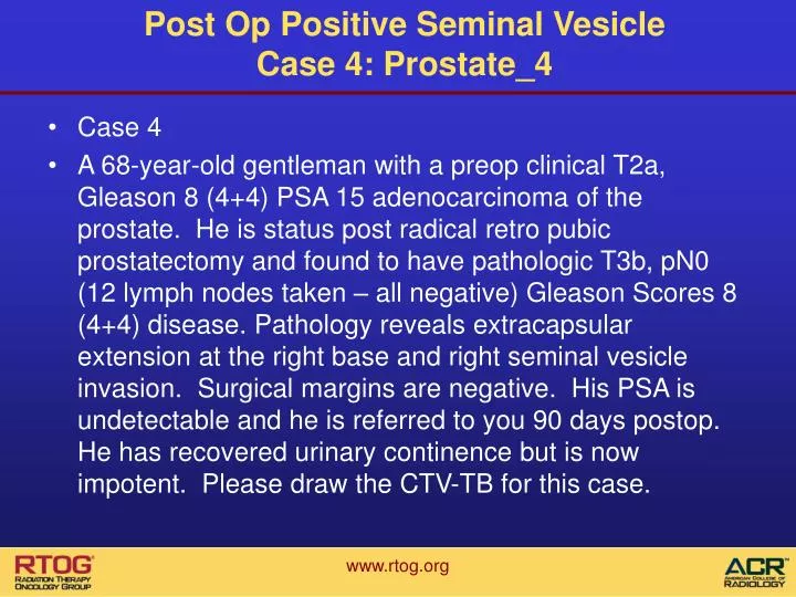 post op positive seminal vesicle case 4 prostate 4