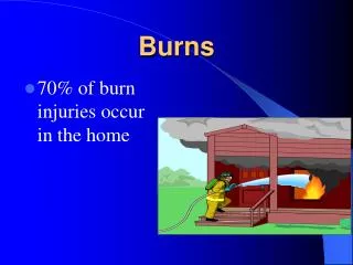 Burns