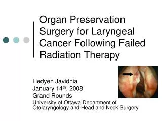 Organ Preservation Surgery for Laryngeal Cancer Following Failed Radiation Therapy