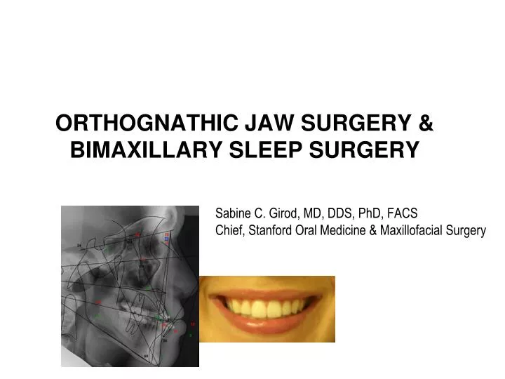orthognathic jaw surgery bimaxillary sleep surgery