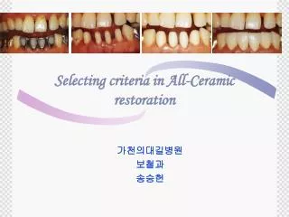 selecting criteria in all ceramic restoration
