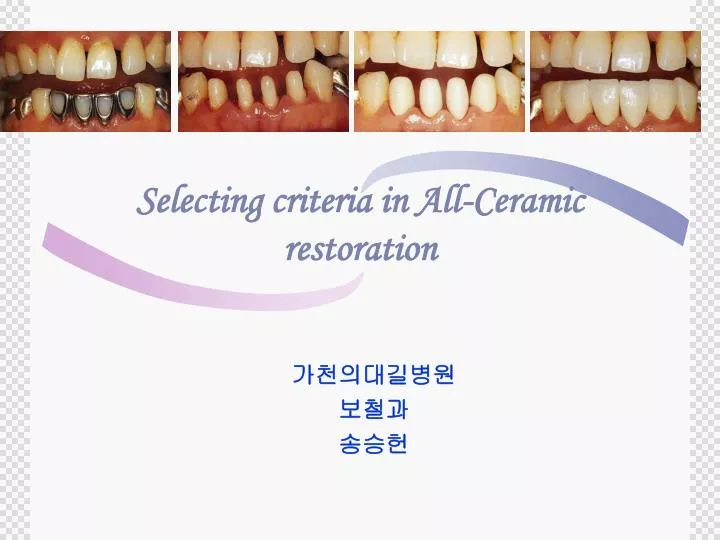 selecting criteria in all ceramic restoration