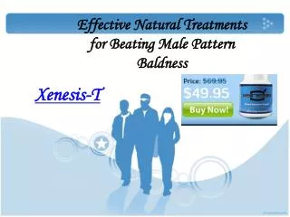 Effective Natural Treatments for Beating Male Pattern Baldne