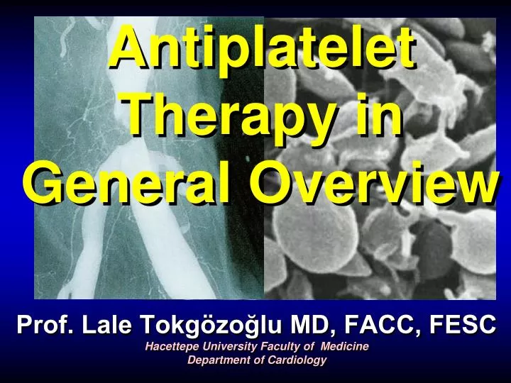 antiplatelet therapy in general overview