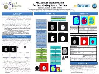 MRI Image Segmentation for Brain Injury Quantification
