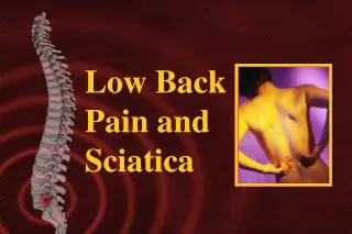 Low Back Pain and Sciatica
