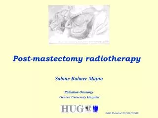 Post-mastectomy radiotherapy