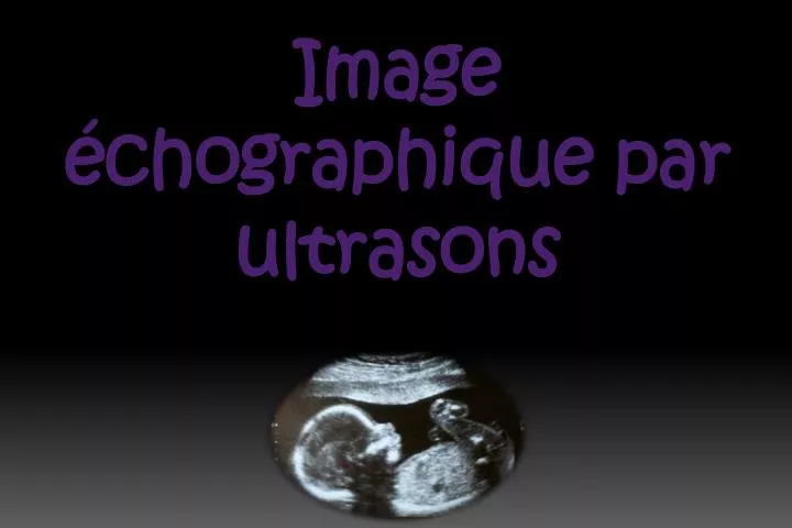 image chographique par ultrasons