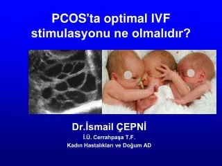 PCOS'ta optimal IVF stimulasyonu ne olmalıdır?