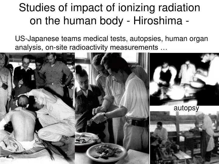 studies of impact of ionizing radiation on the human body hiroshima