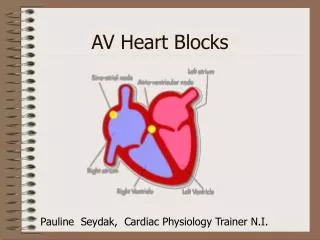 AV Heart Blocks