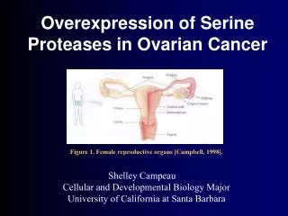 Overexpression of Serine Proteases in Ovarian Cancer