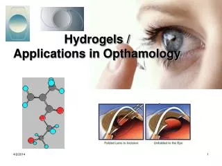 Hydrogels / Applications in Opthamology