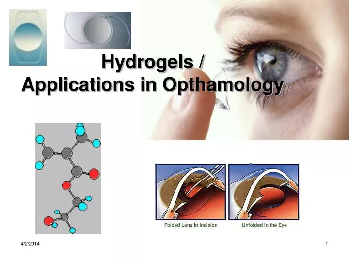 hydrogels applications in opthamology