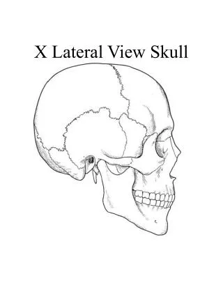 X Lateral View Skull