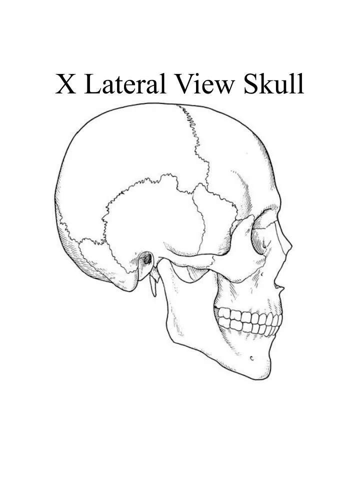 x lateral view skull