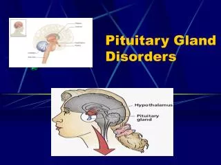 Pituitary Gland Disorders
