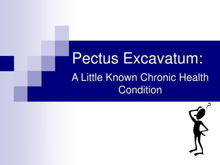 pectus excavatum