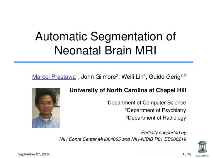 automatic segmentation of neonatal brain mri