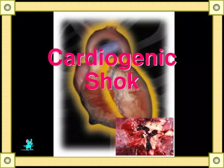 cardiogenic shok