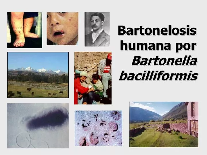 bartonelosis humana por bartonella bacilliformis