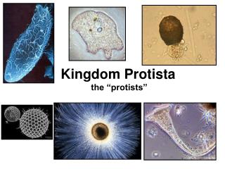 Kingdom Protista the “protists”