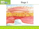 Stage 1 - slide 1