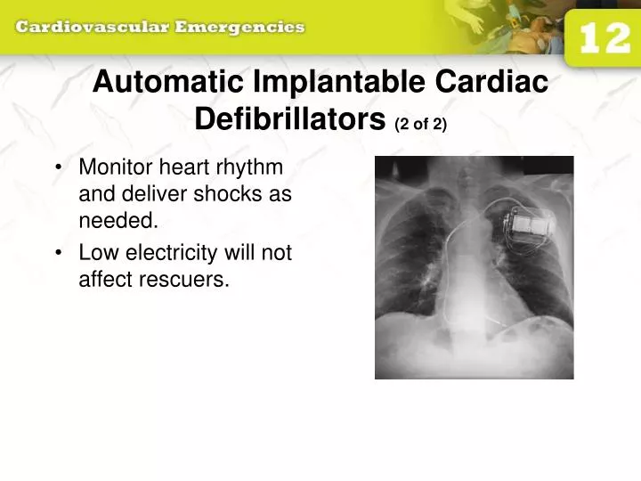 automatic implantable cardiac defibrillators 2 of 2