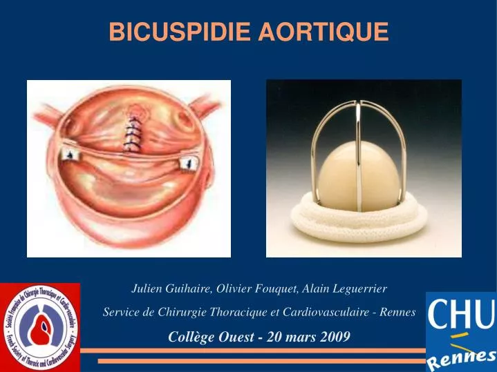 bicuspidie aortique
