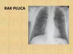 RAK PŁUCA - slide 1