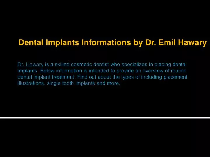 dental implants informations by dr emil hawary