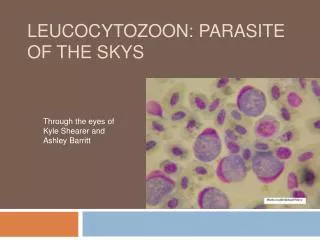 Leucocytozoon : Parasite of the skys