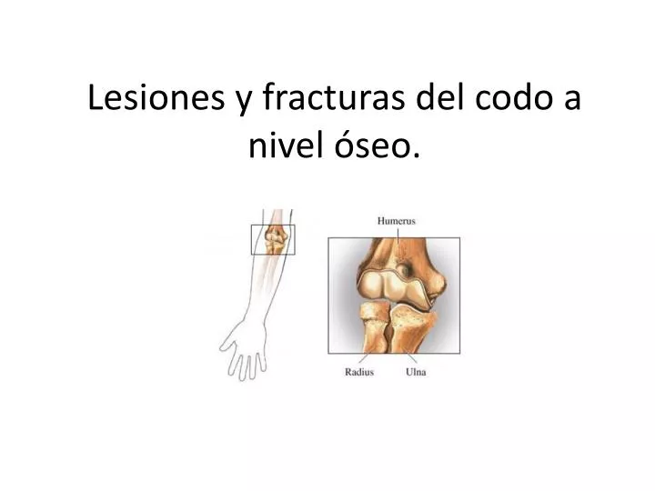 lesiones y fracturas del codo a nivel seo