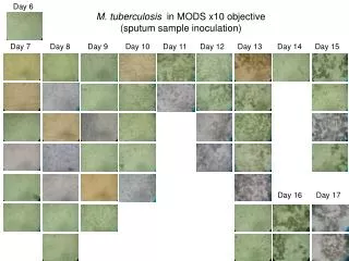 M. tuberculosis in MODS x10 objective (sputum sample inoculation)