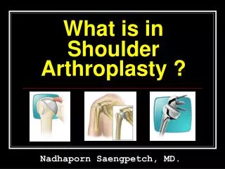 What is in Shoulder Arthroplasty ?