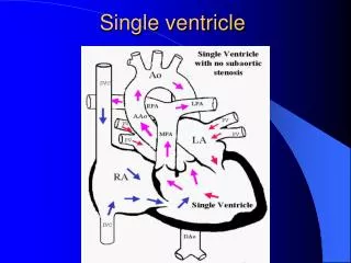 Single ventricle