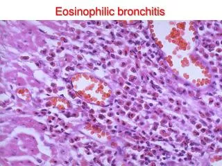 Eosinophilic bronchitis