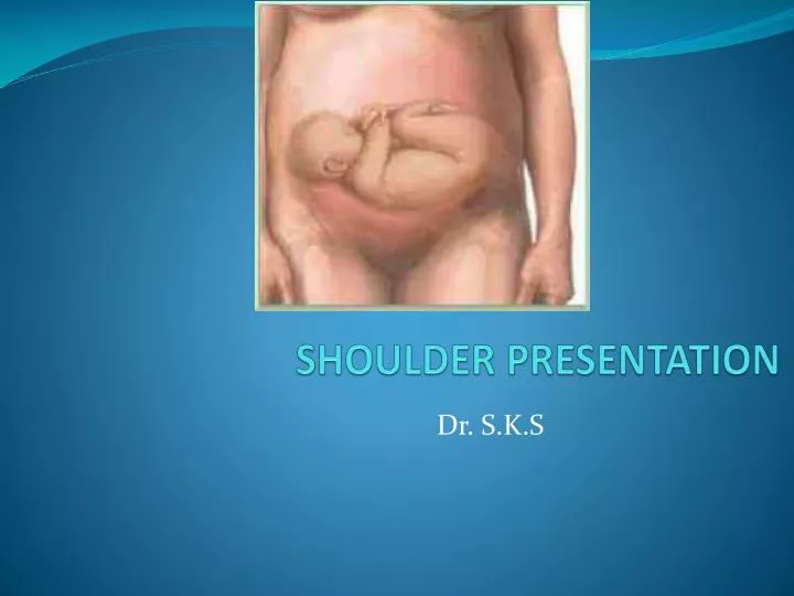 shoulder presentation