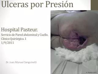 Ulceras por Presión Hospital Pasteur. Servicio de Pared abdominal y Cuello. Clínica Quirúrgica. 1 1/9/2011