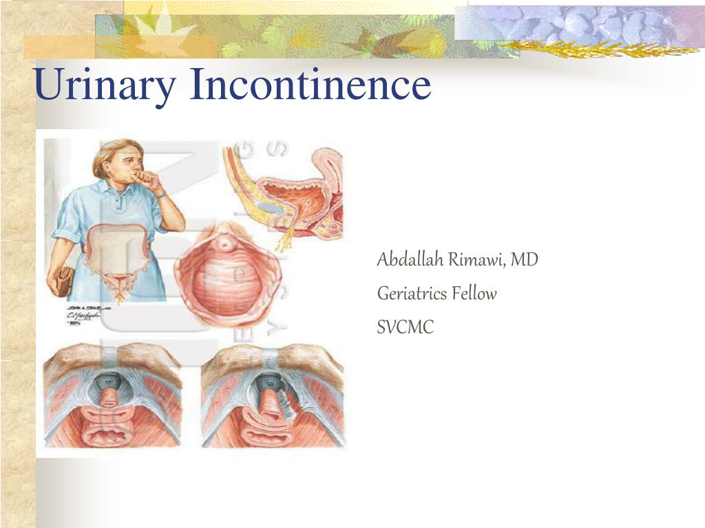 PPT - Urinary Incontinence PowerPoint Presentation, free download - ID ...