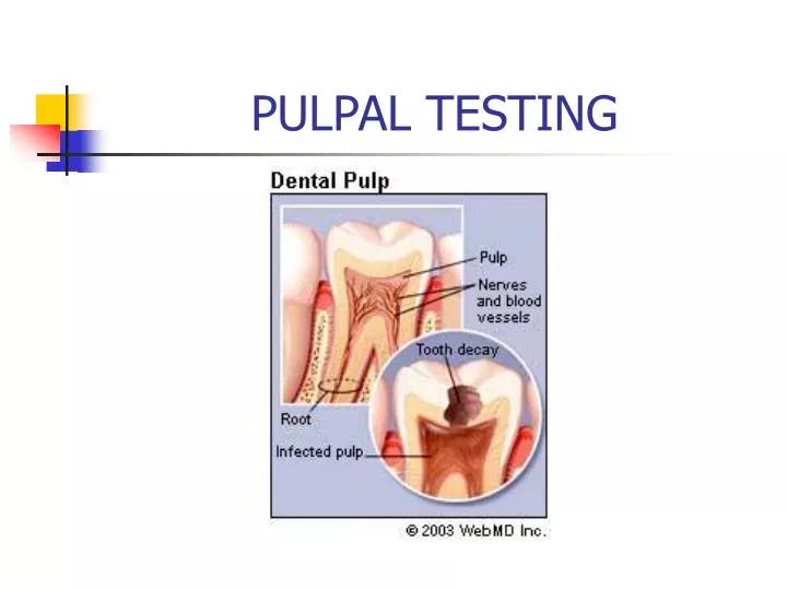 pulpal testing