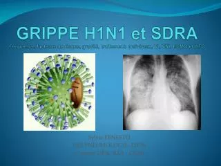 GRIPPE H1N1 et SDRA Fréquence, facteurs de risque, gravité, traitement: antiviraux, VI, VNI, ECMO et HFO